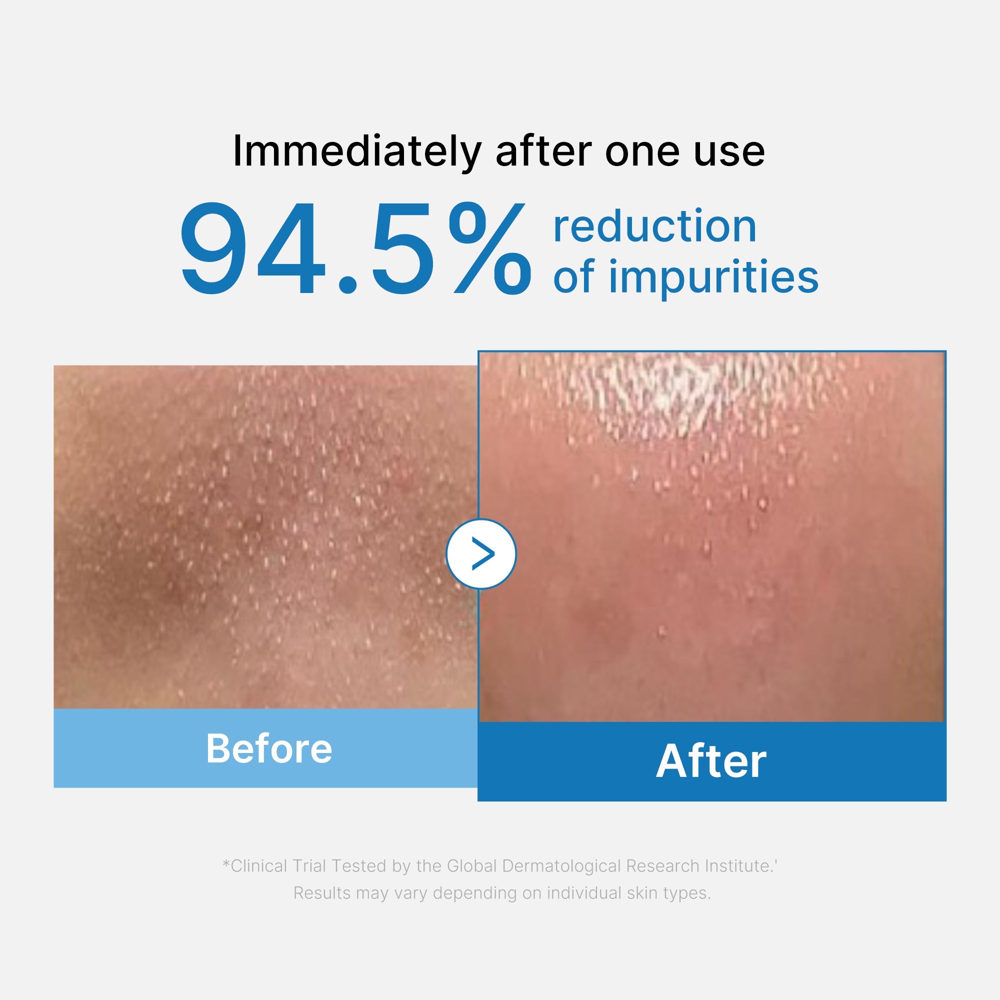 [Subscr.] Zero Pore Blackhead Deep Cleansing Oil