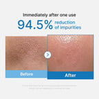 Zero Pore Blackhead Deep Cleansing Oil