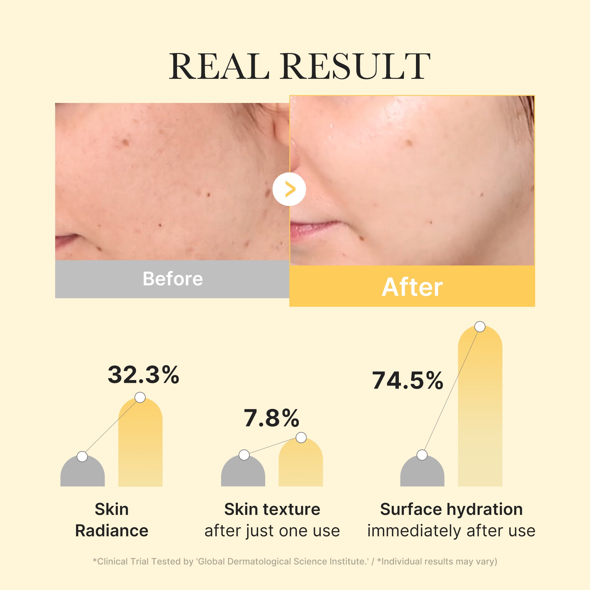 [Subscr.] Kojic Acid Turmeric Gold Jelly Gel Mask