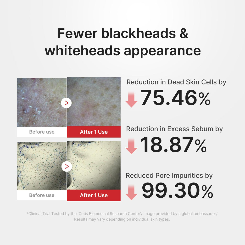 Hypochlorous Acid Rice Peel Shot