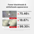 Hypochlorous Acid Rice Peel Shot