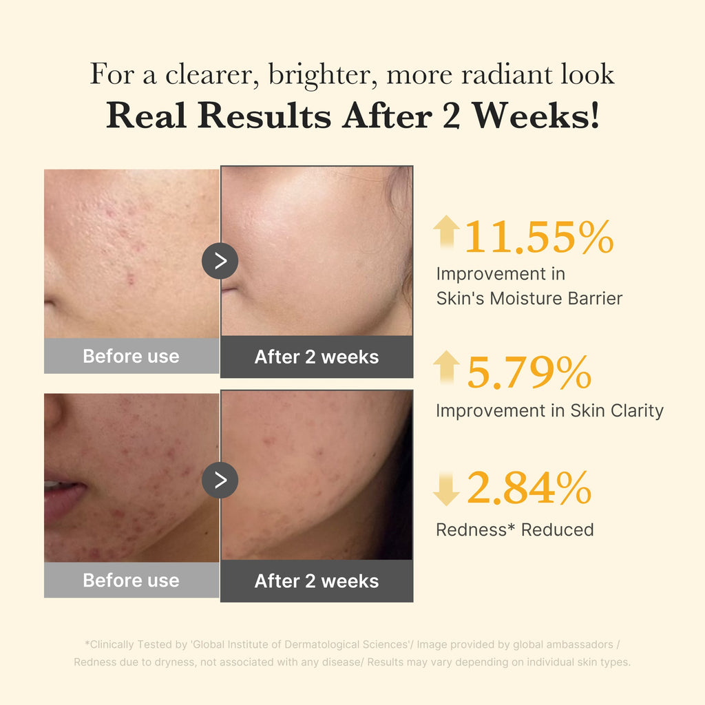 [Subscr.] Kojic Acid Turmeric Capsule Serum