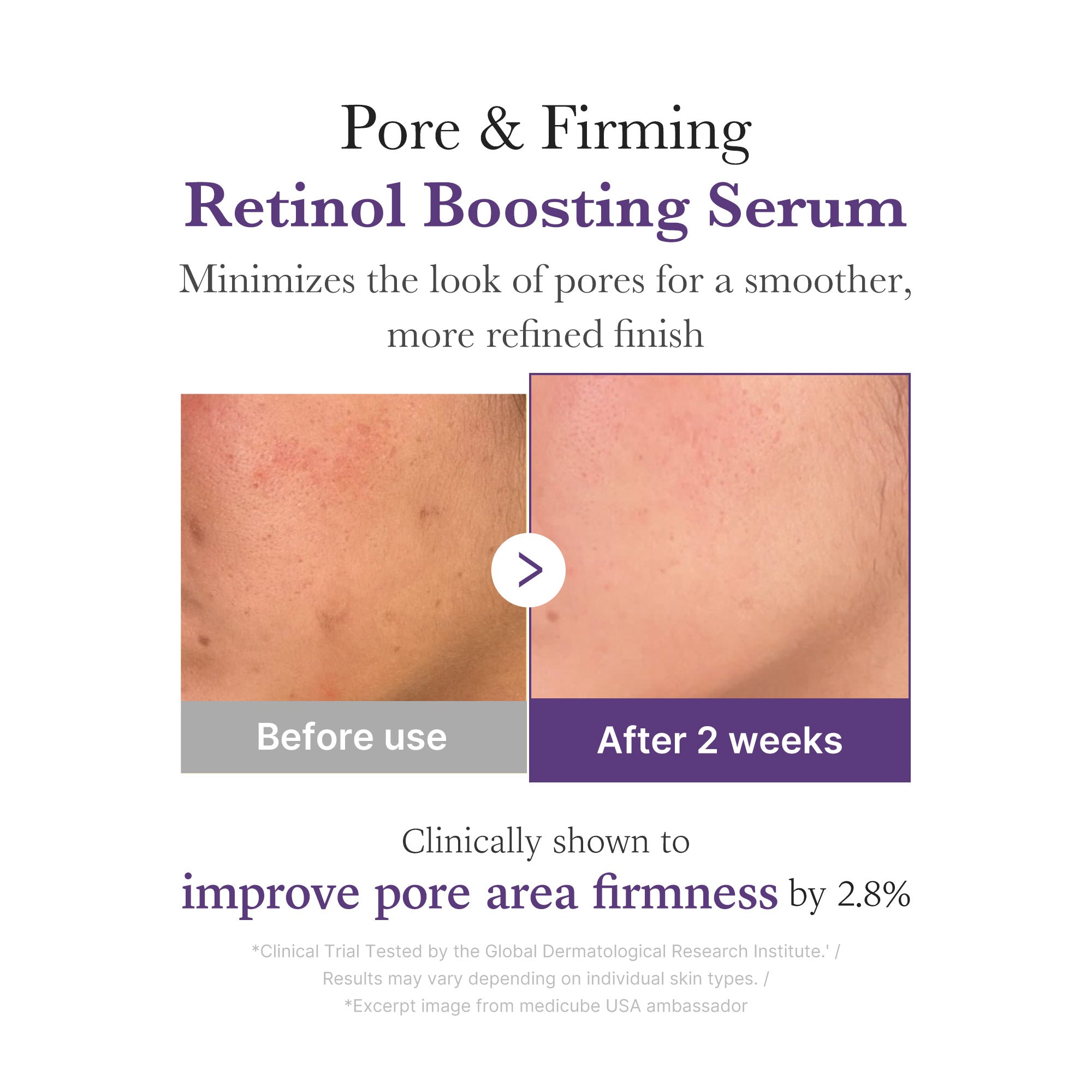 [Subscr.] Retinol NMN Boosting Serum