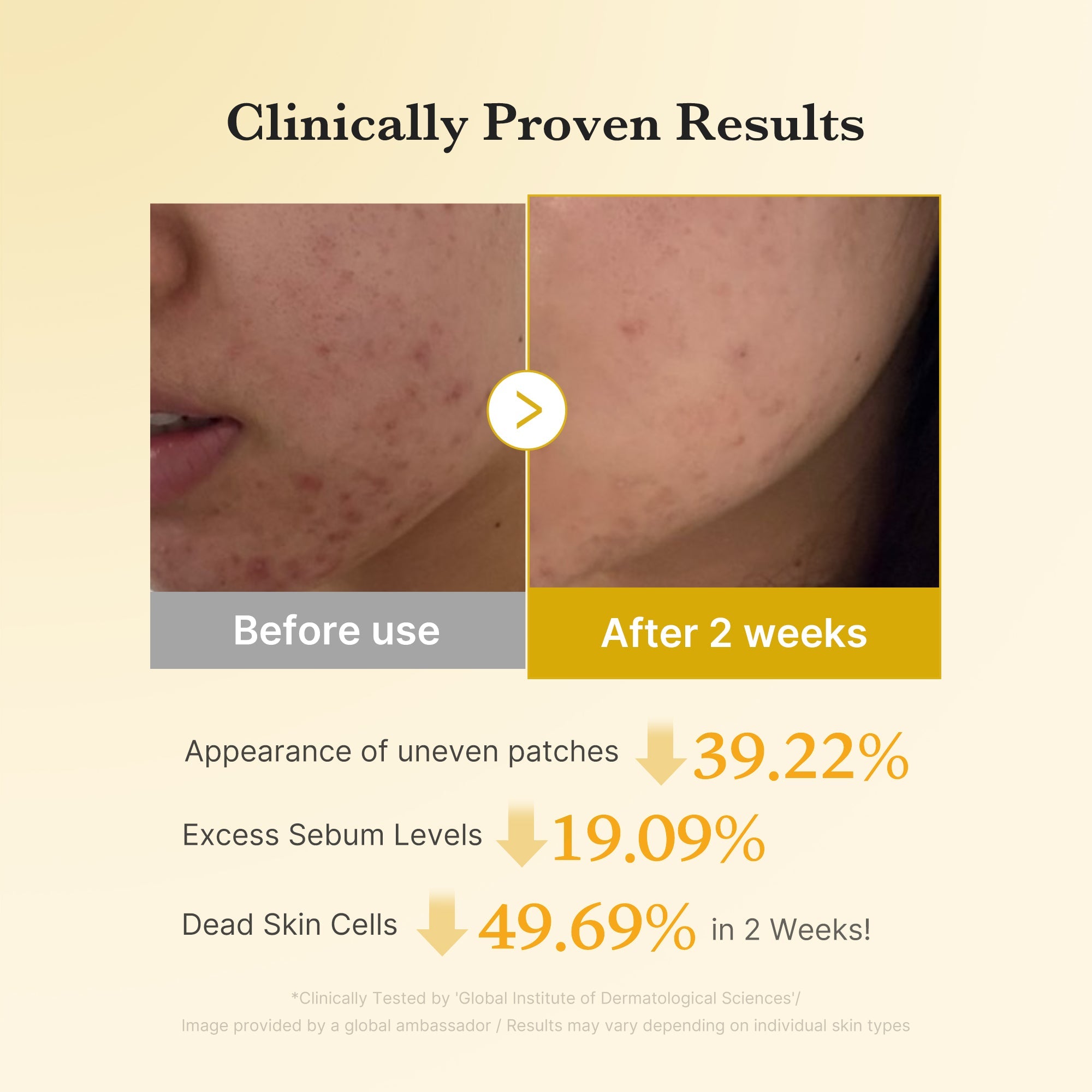 [Subscr.] Kojic Acid Tumeric Toner Pad