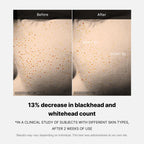 Zero Pore One-day Serum