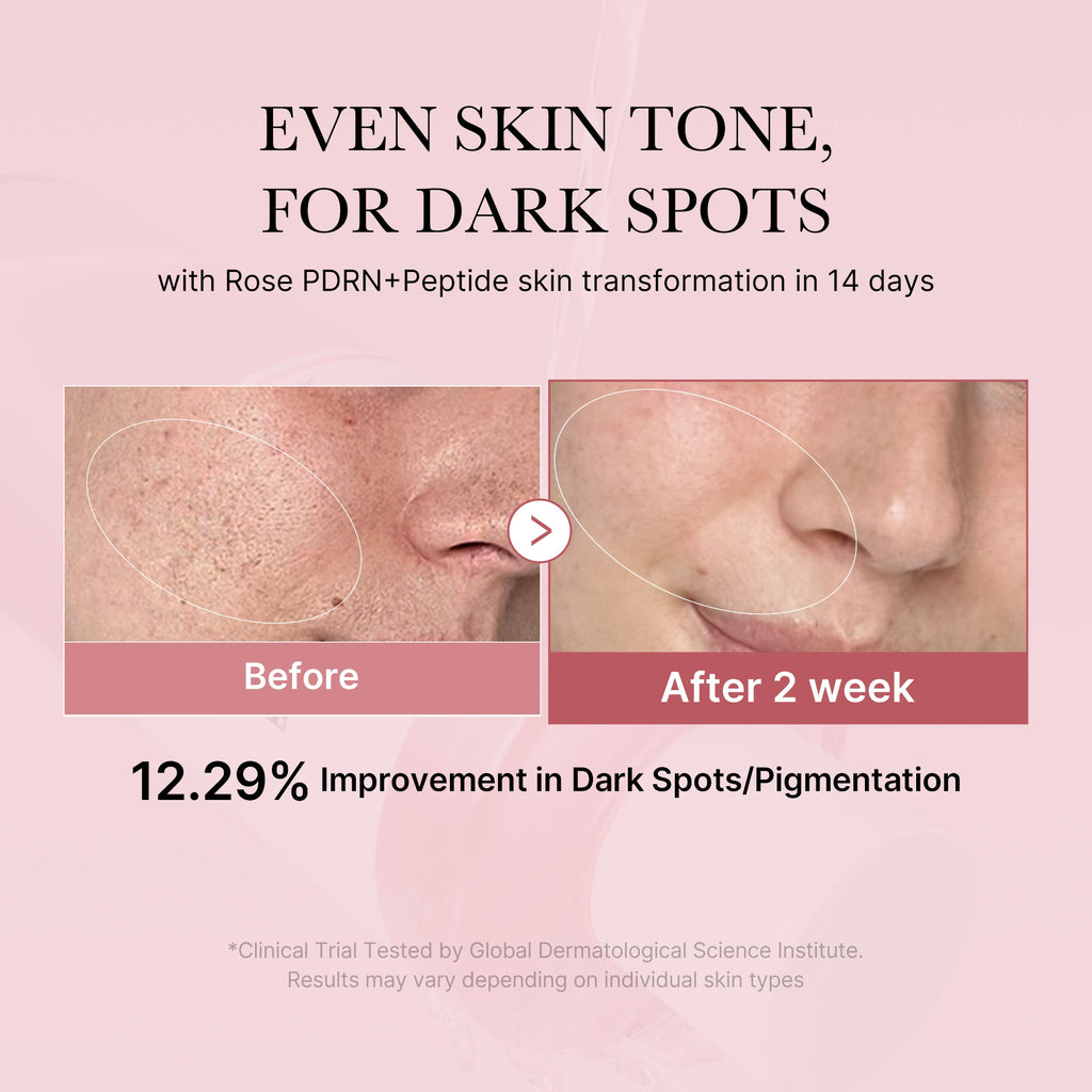 [Subscr.] PDRN Pink Peptide Toner