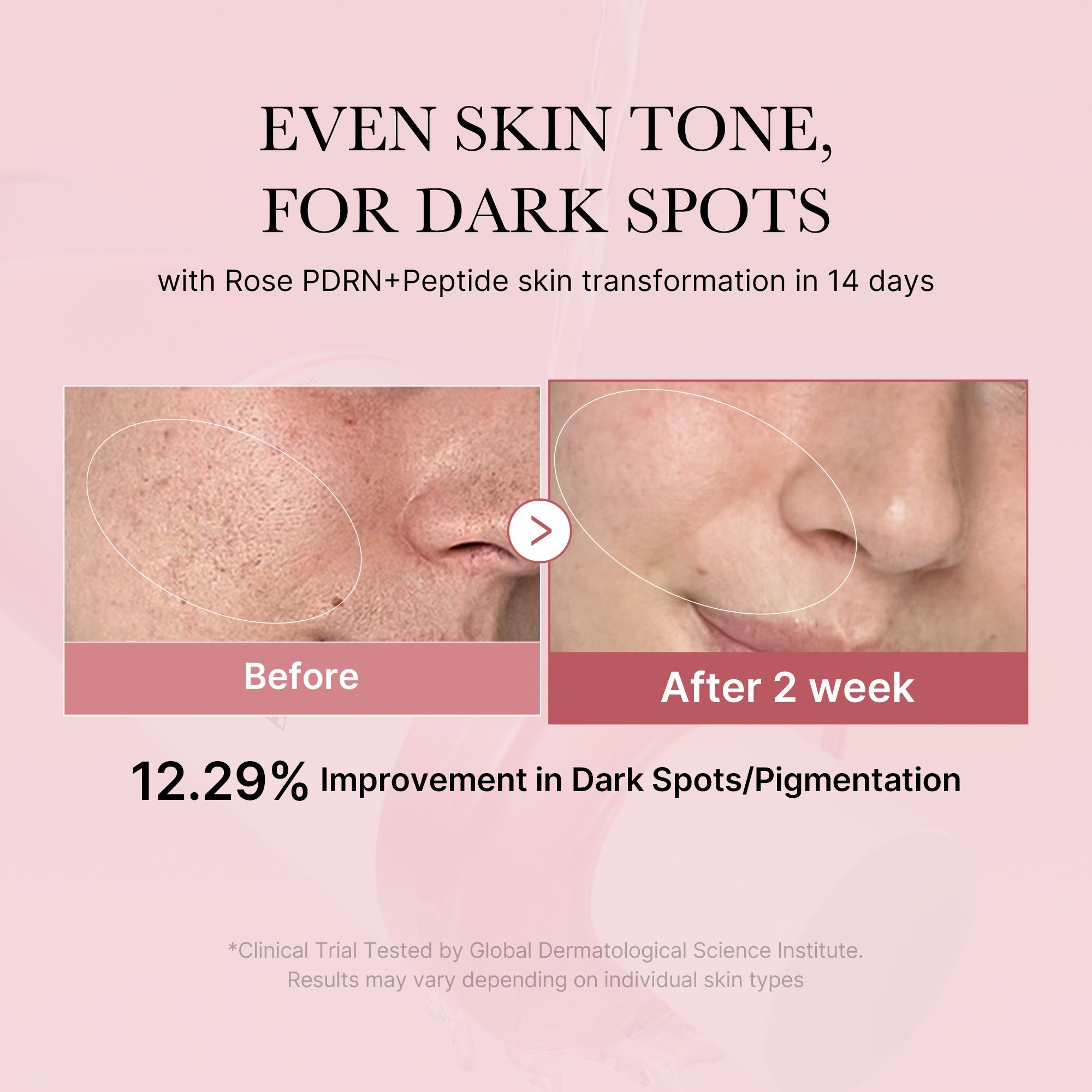 [Subscr.] PDRN Pink Peptide Toner