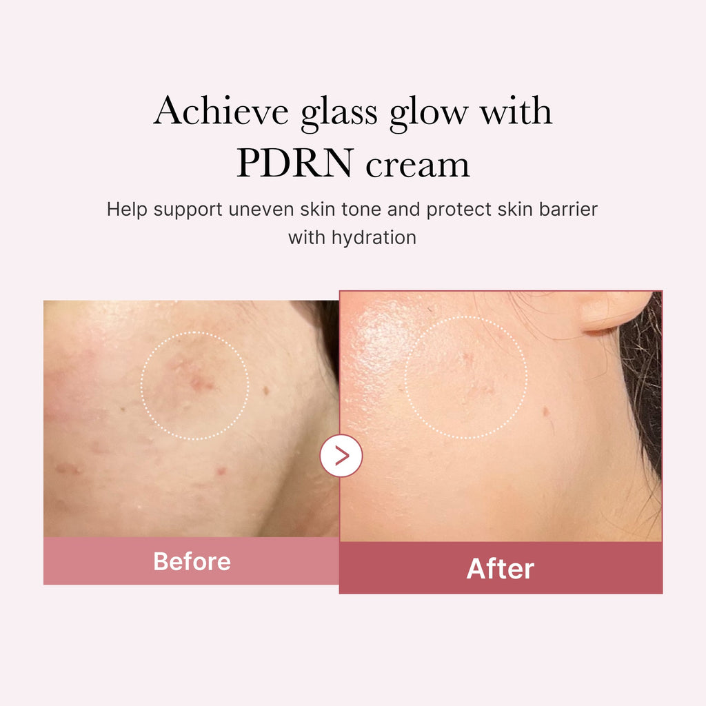 [Subscr.] PDRN Pink Peptide Cream